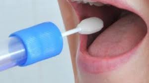 Test e tamponi